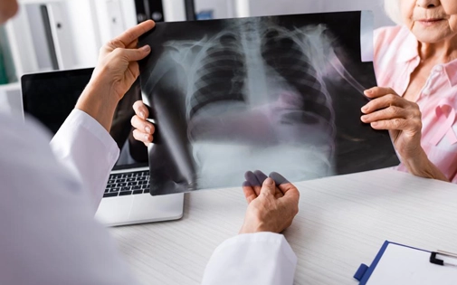 Chest X-Ray Ankara, Turkey